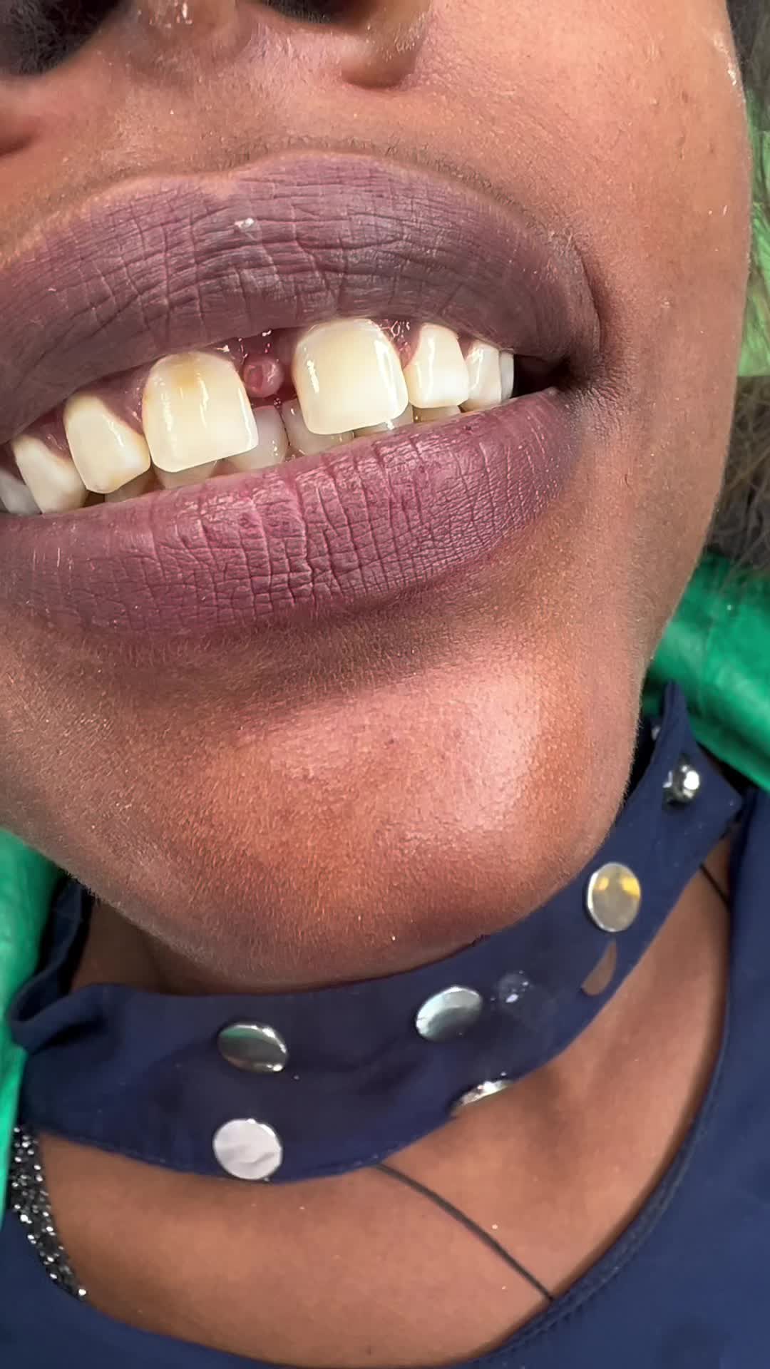 @drhelina_smile_architect