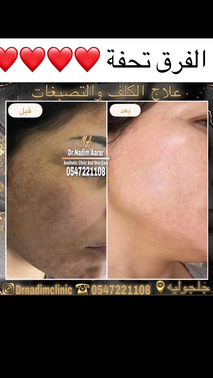 @0547221108 - Drnadimclinic