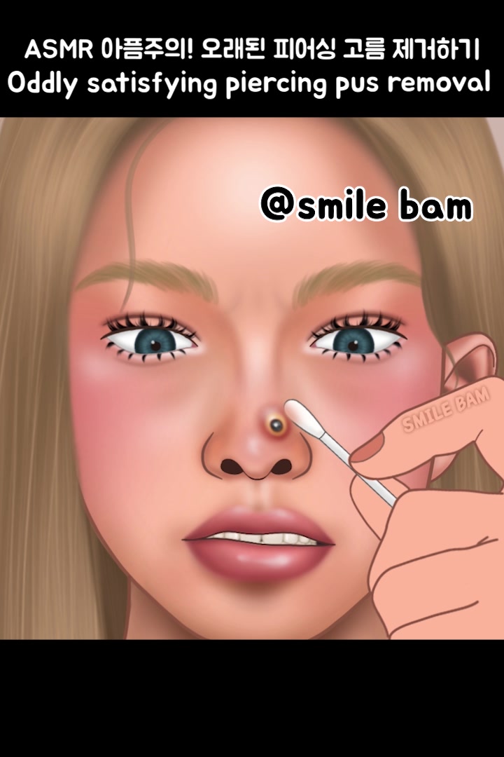 @Smile Bam