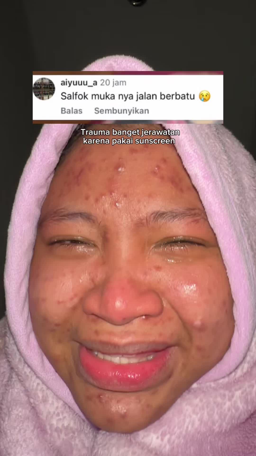 @MBAK CUNGCAT BAYI