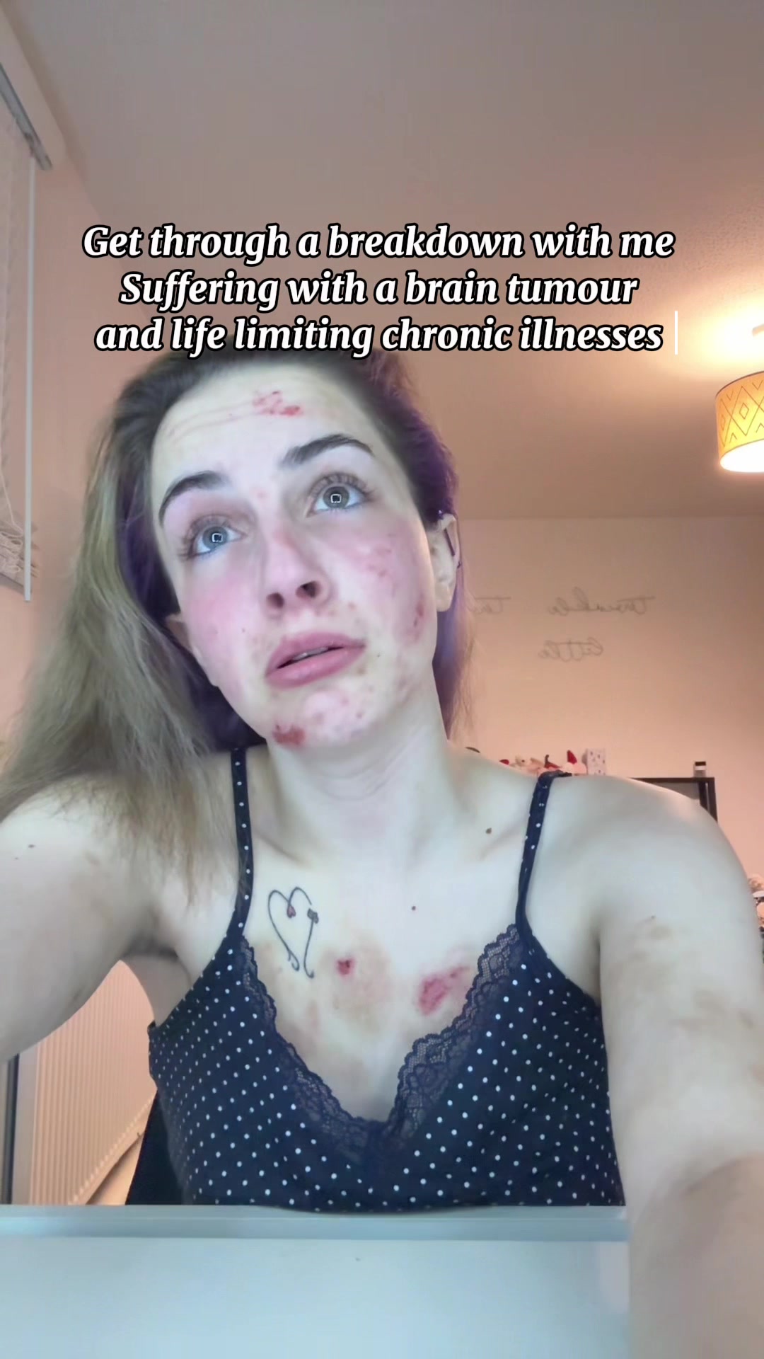 @Bethschronicdiaries 🦋❤️&zwj;🔥♿️
