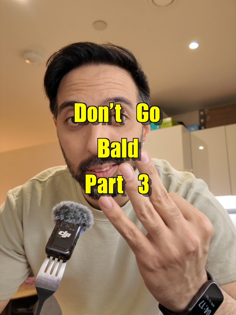 @Amit | Hair Transplant Tips