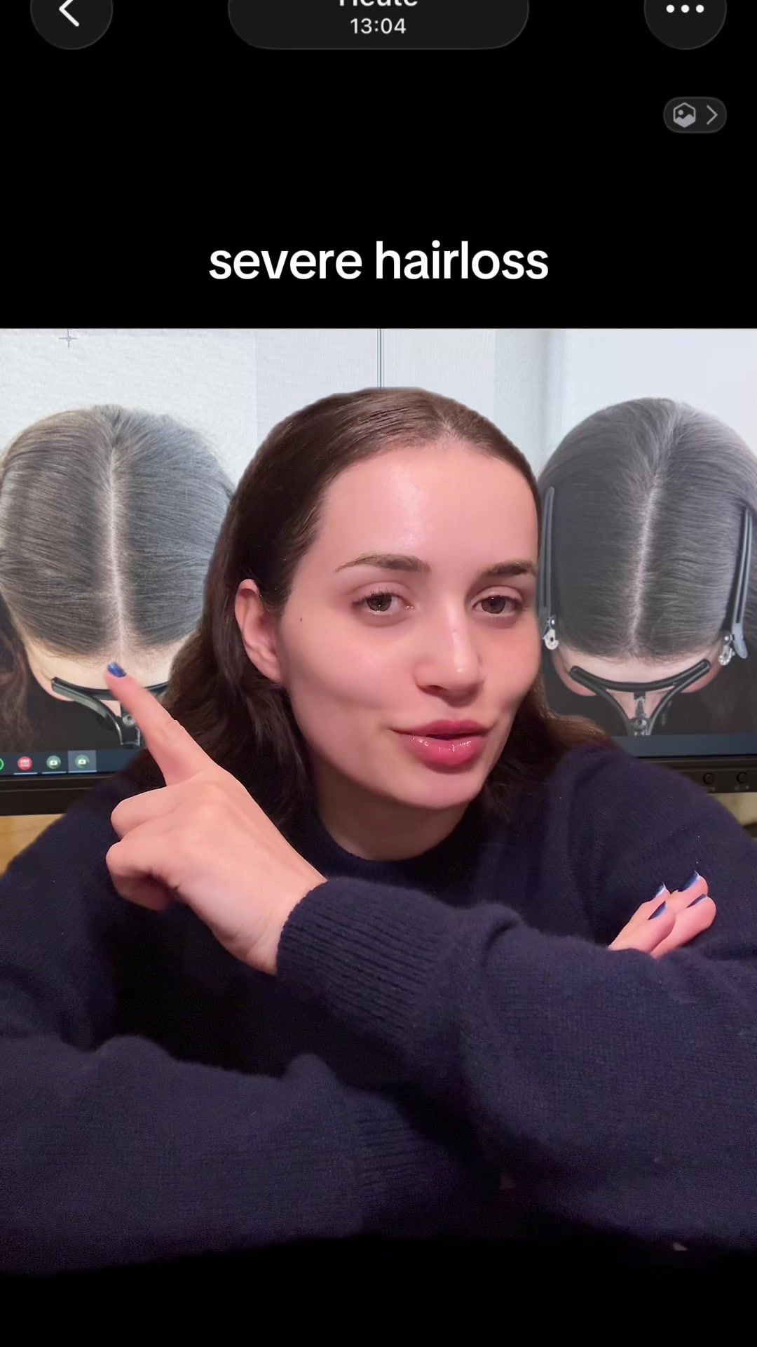 @Basicela_