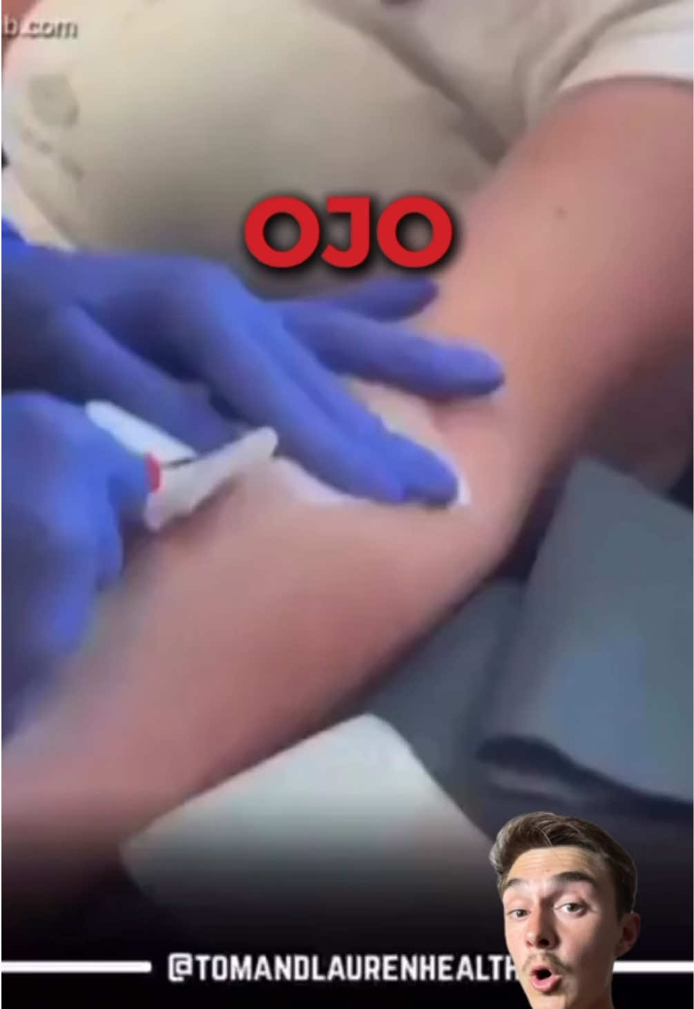 @DietAlvaro