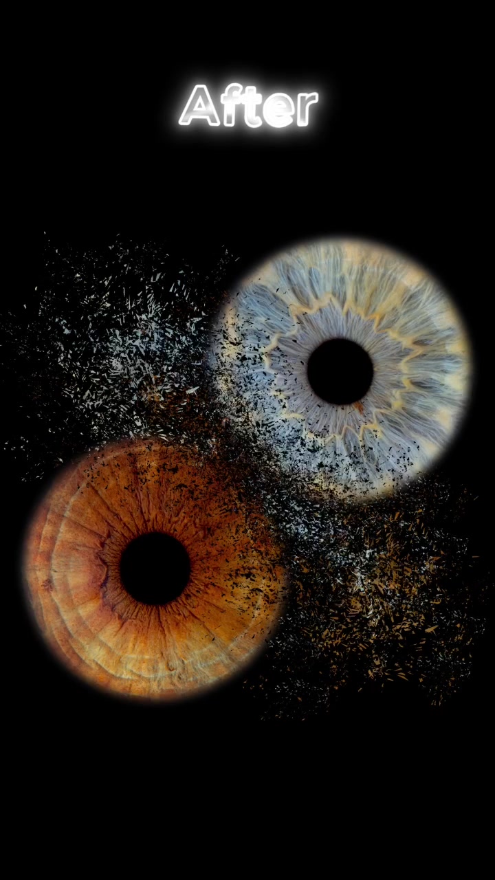 @EyesHunter