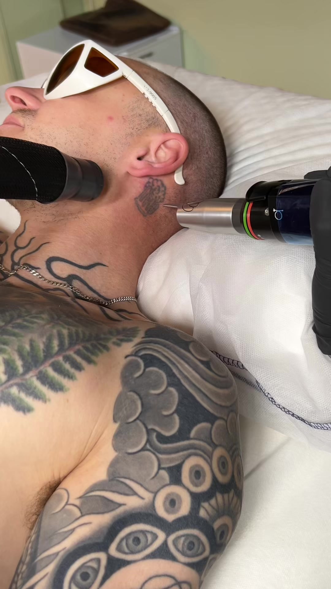 @Swift_tattoo_removal