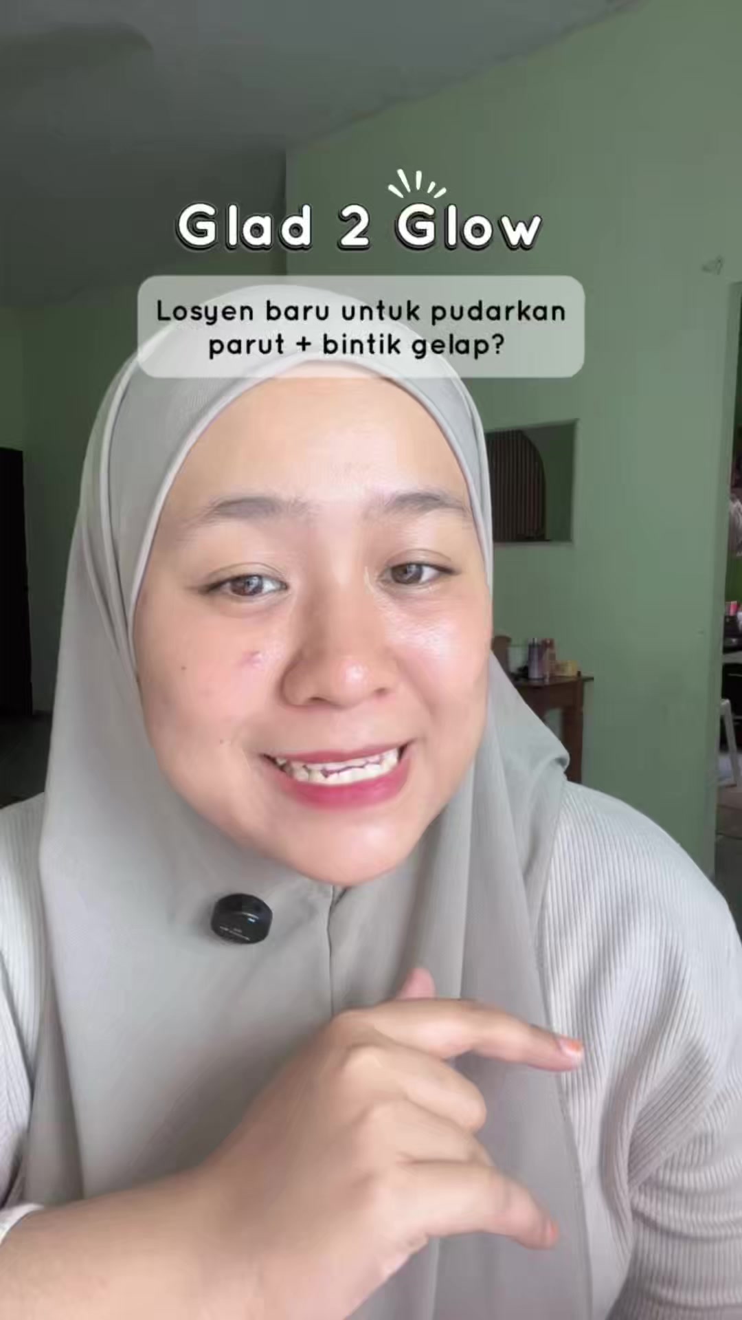 @Diana Adi