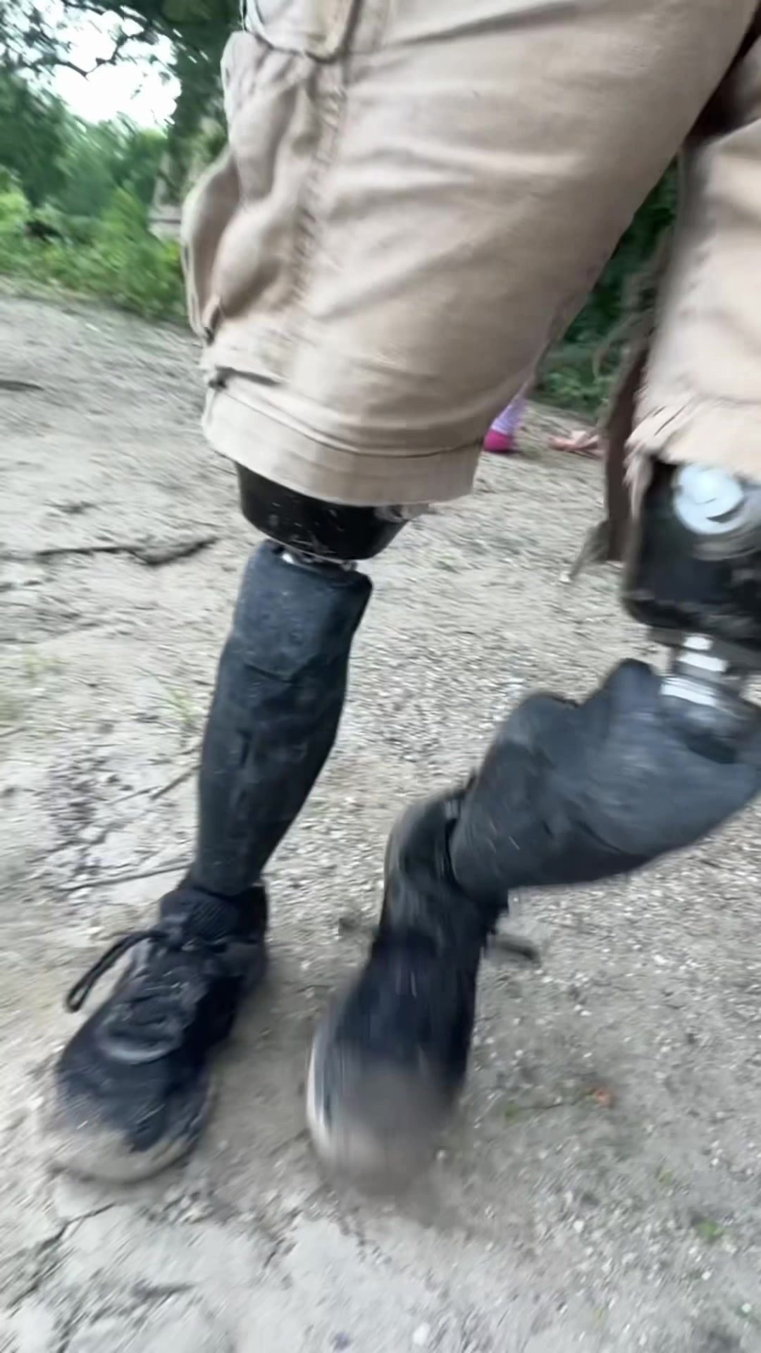 @Limb Loss Boss