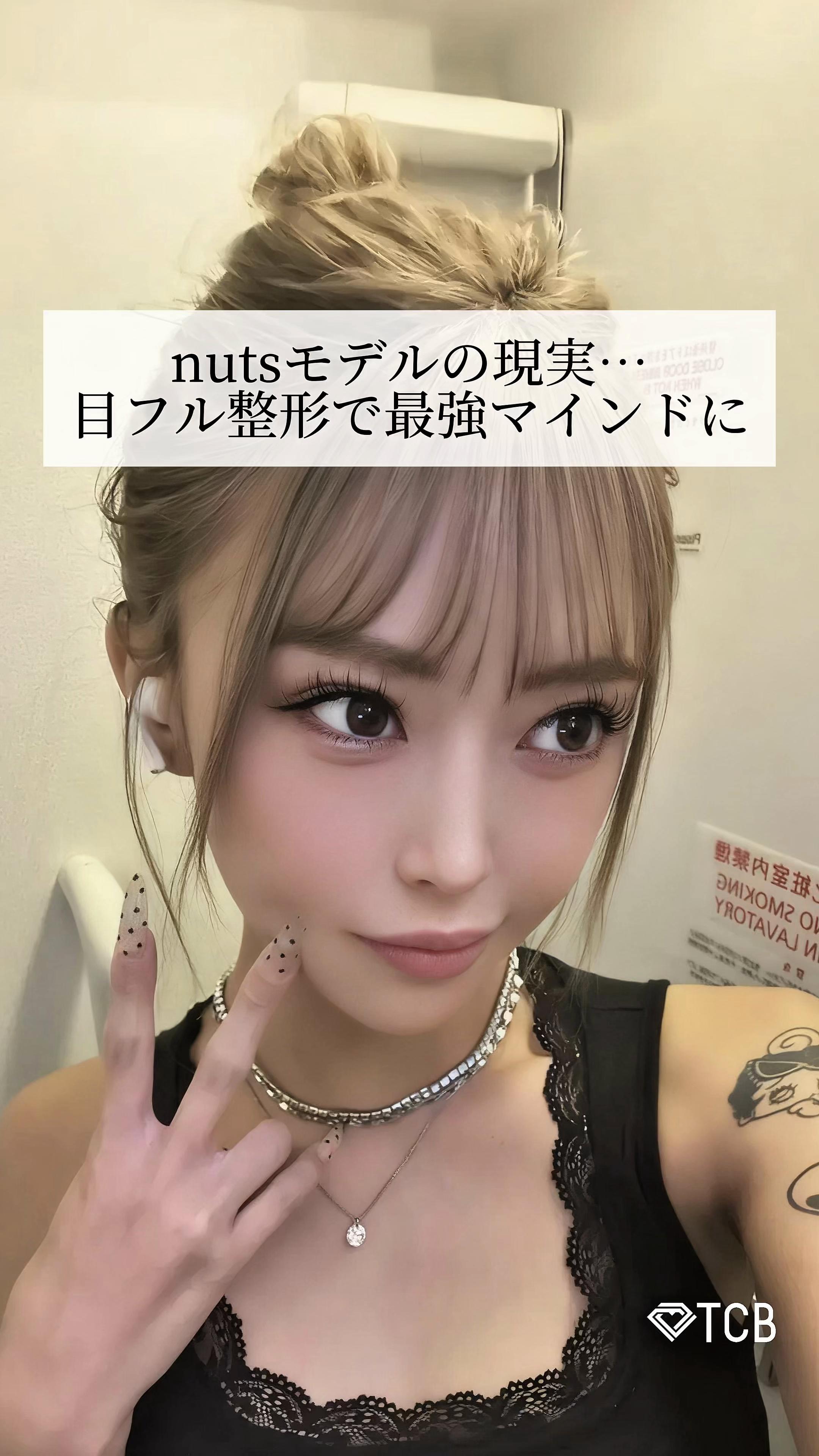 @【二重整形】TCB 新宿東口院ゆいこ先生/東京