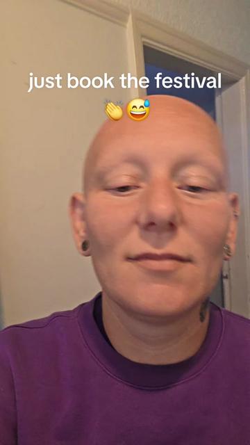 @baldies_adventures