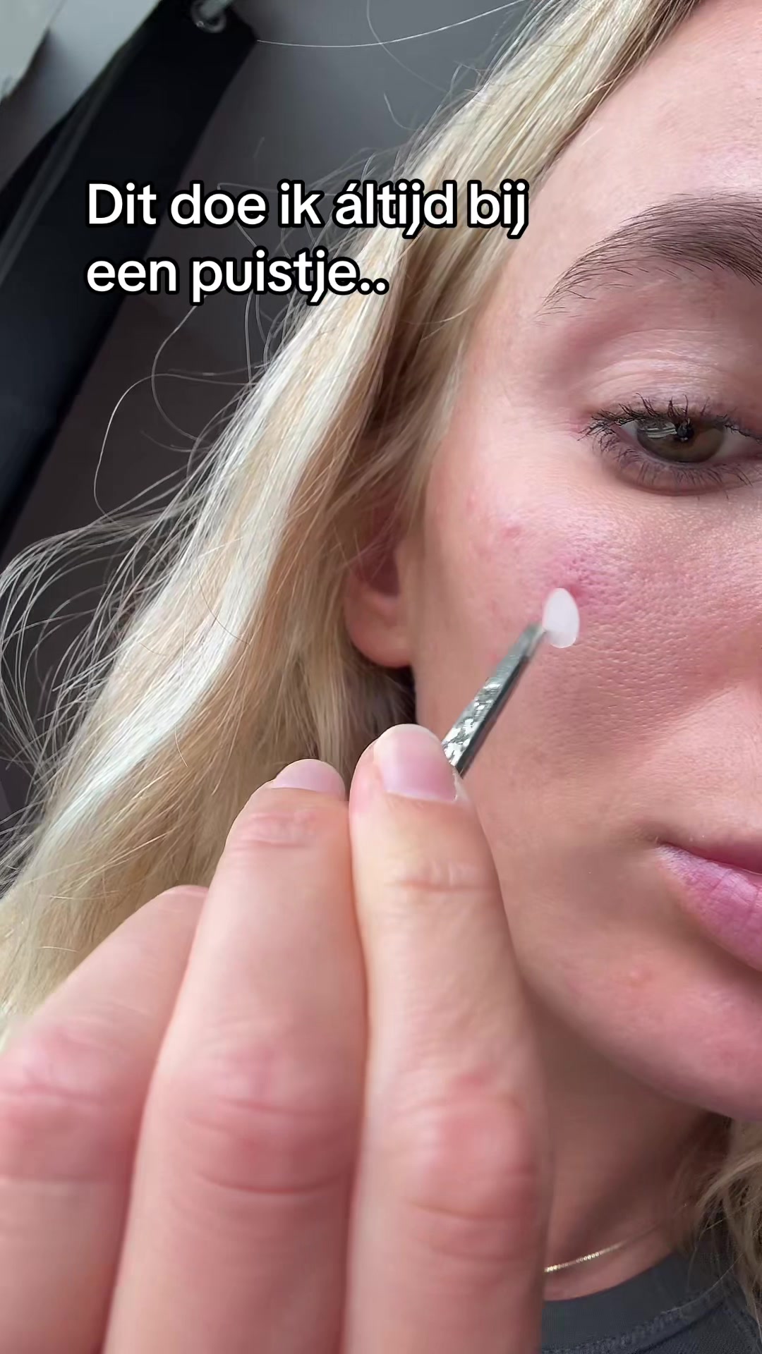 @Skinfixer