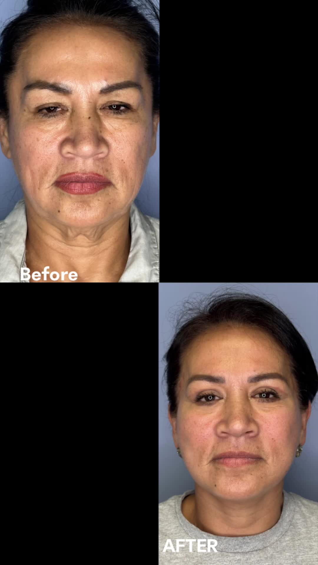 @Dr. Manuel Sevillano