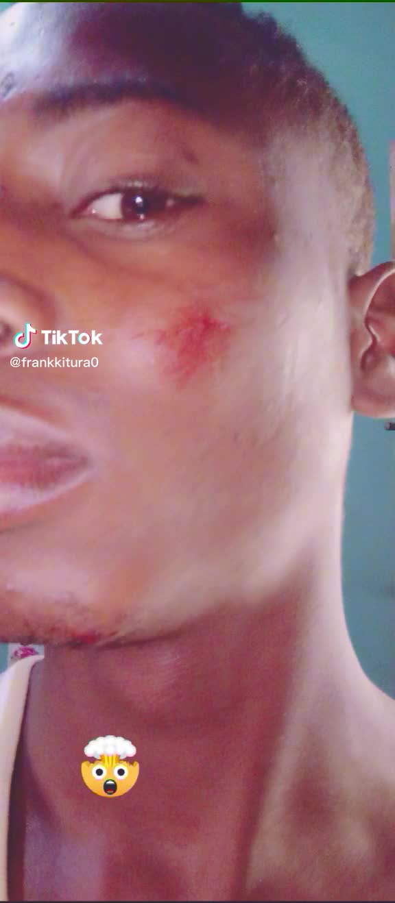@frankkitura