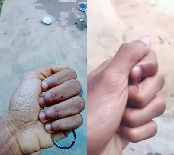 @Achu