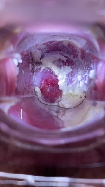 @Obstetric.Care