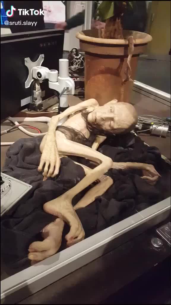 @Sathwik