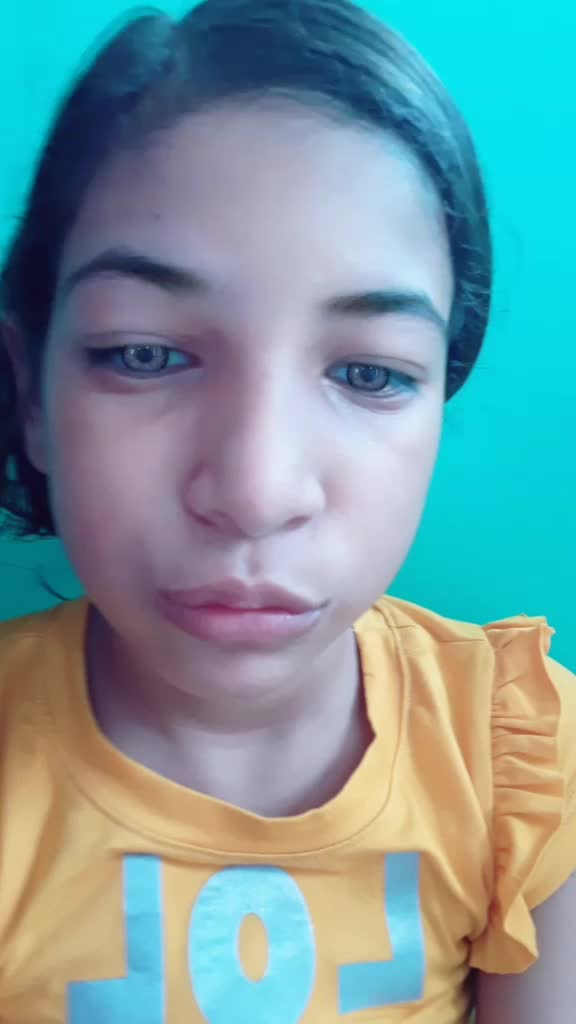 @vale104