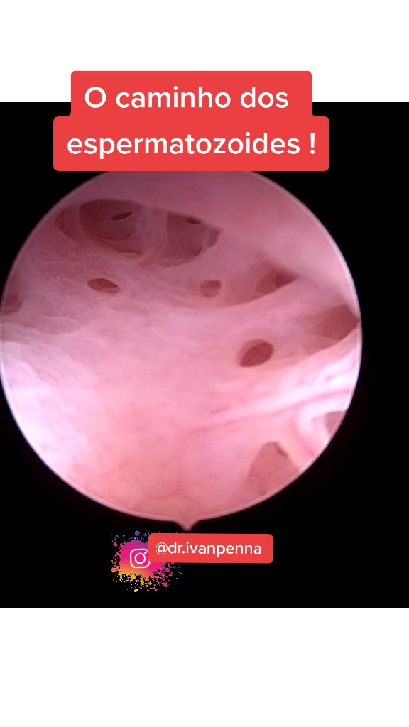 @Dr.ivanpenna