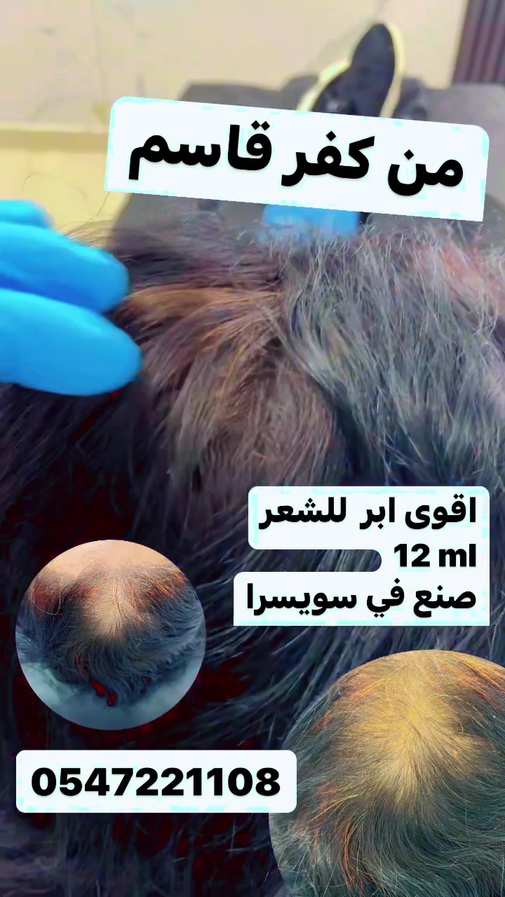 @0547221108 - Drnadimclinic
