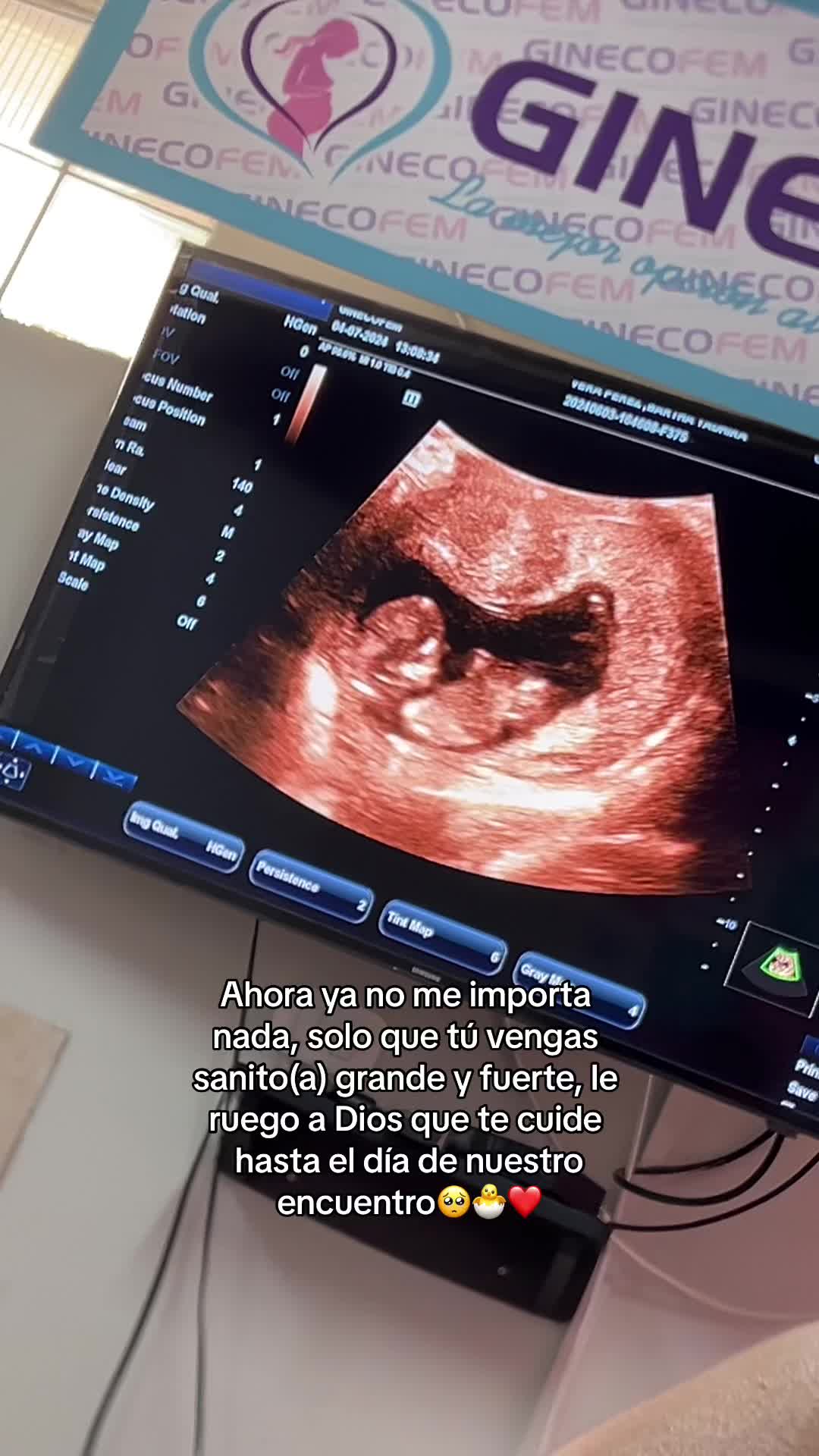 @Yayi 🤎