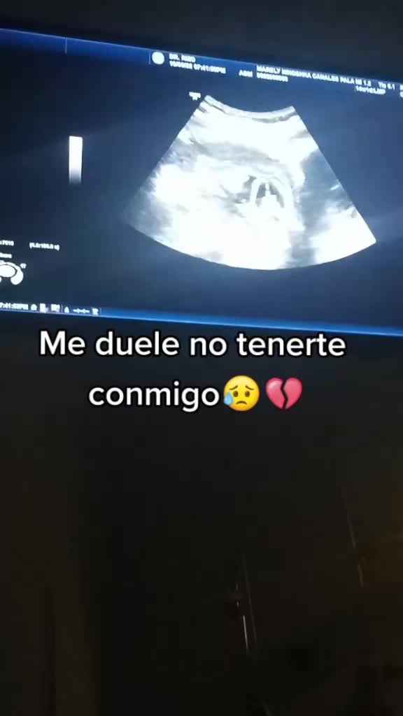 @Ninoxmx