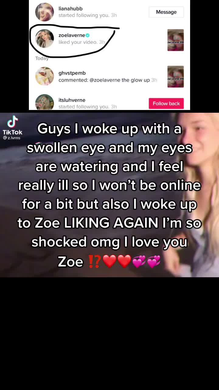 @ZOE NOTICED 💞