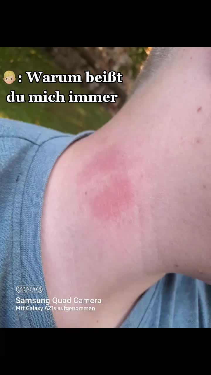 @Emmi