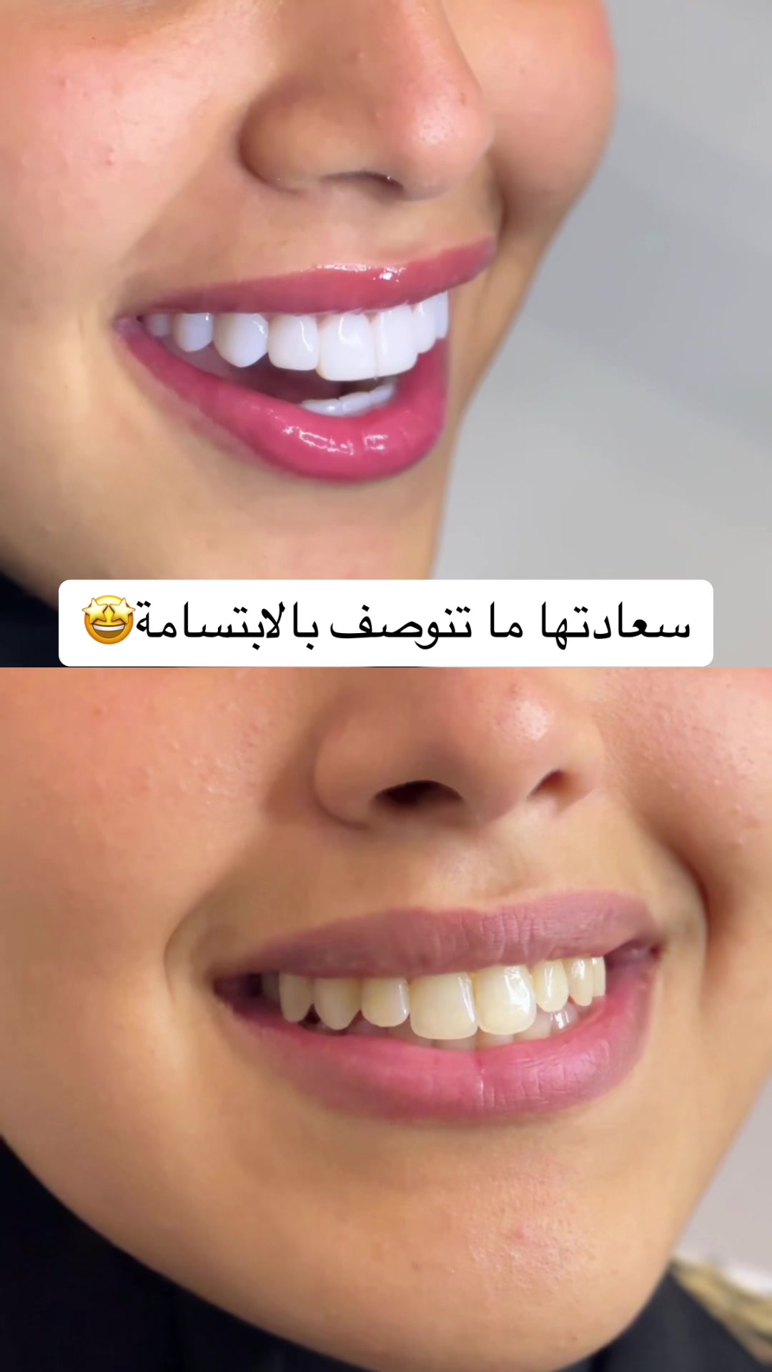 @عيادات البا للابتسامة