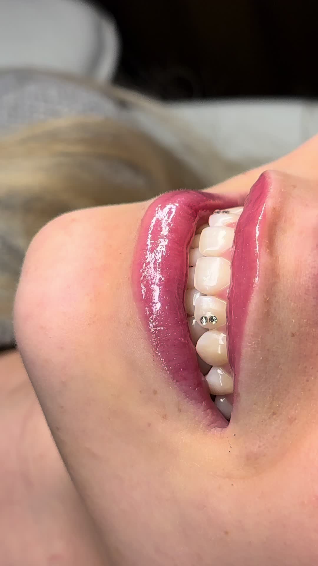 @Zahnschmuck_