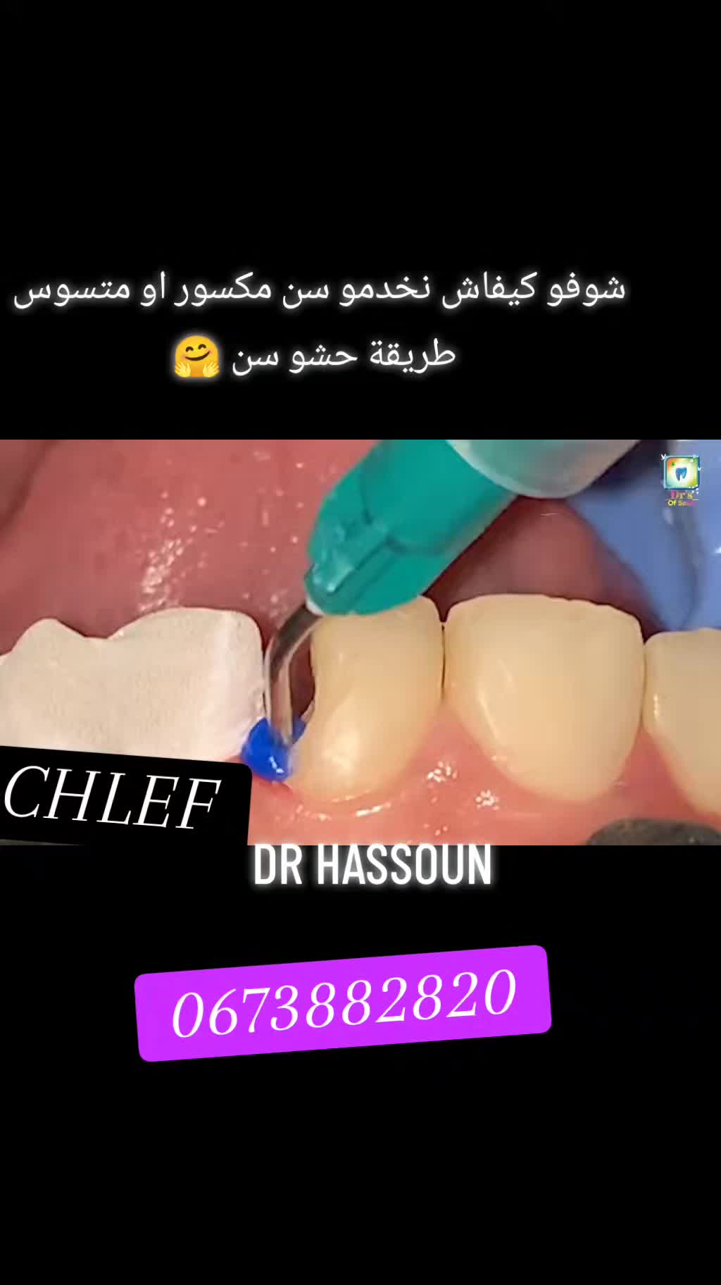 @Dr HASSOUN02 طبيبة الاسنان شلف