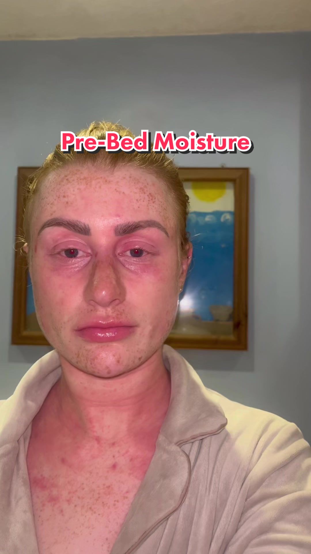 @my journey to repair my skin
