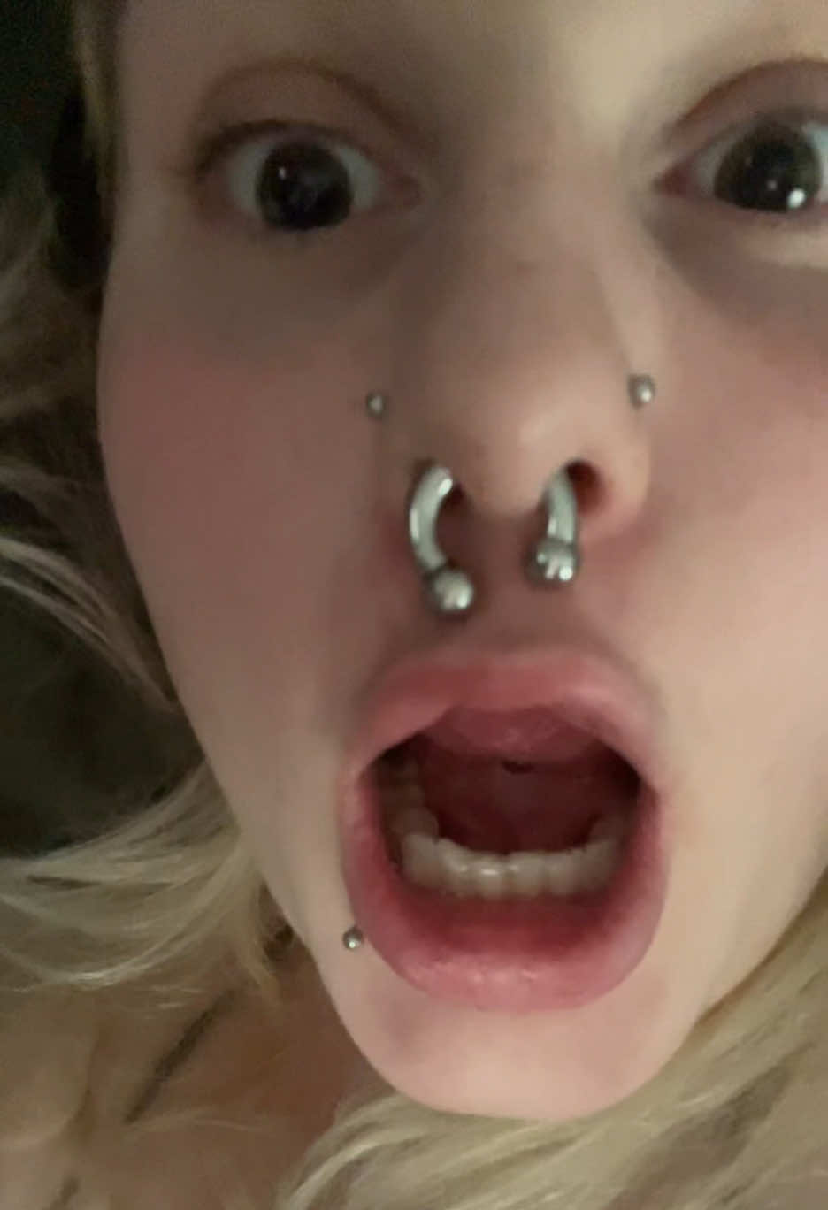 @(stella) not underboob
