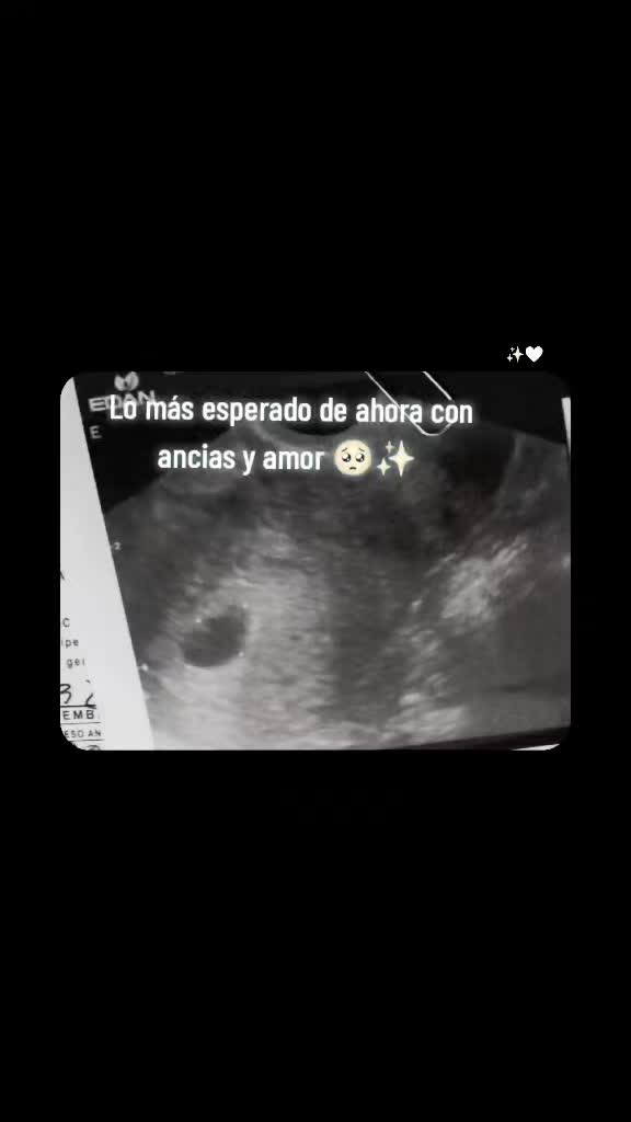@@Astrid.guzman