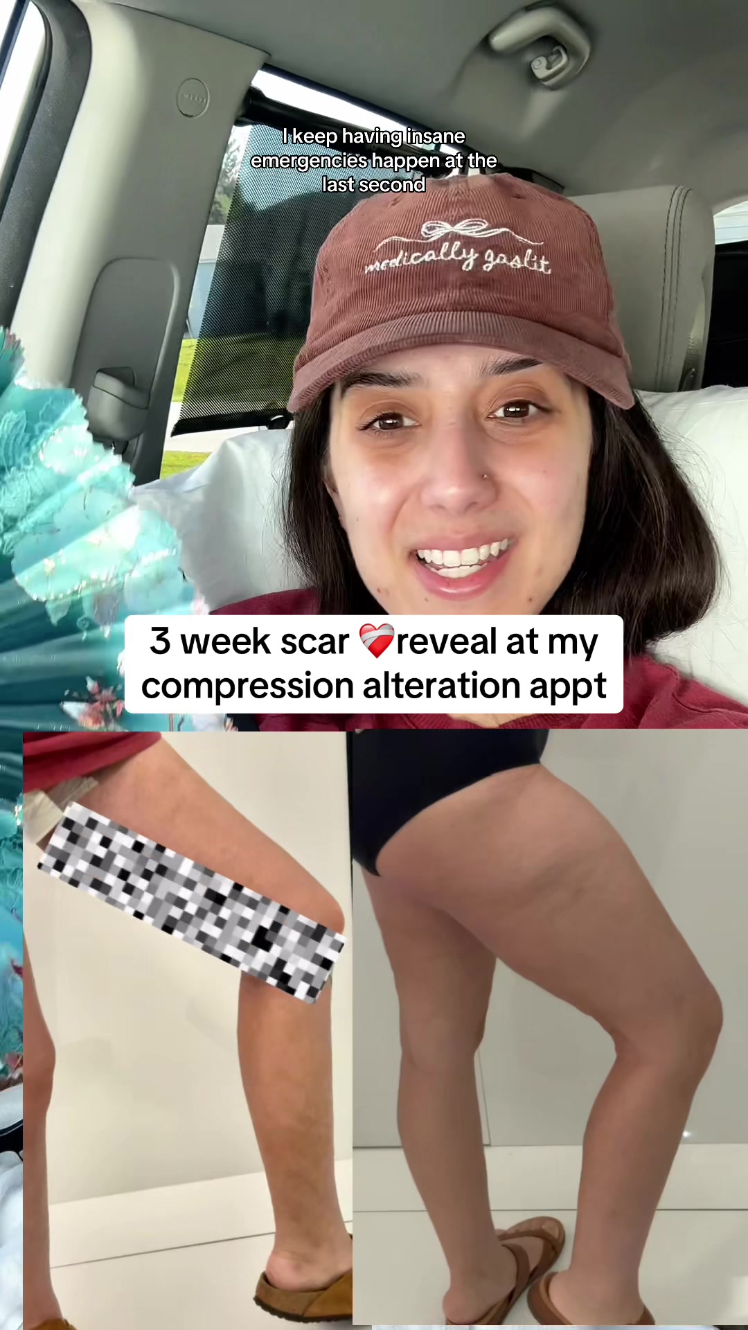 @Heather 𖤓 PCOS Princess