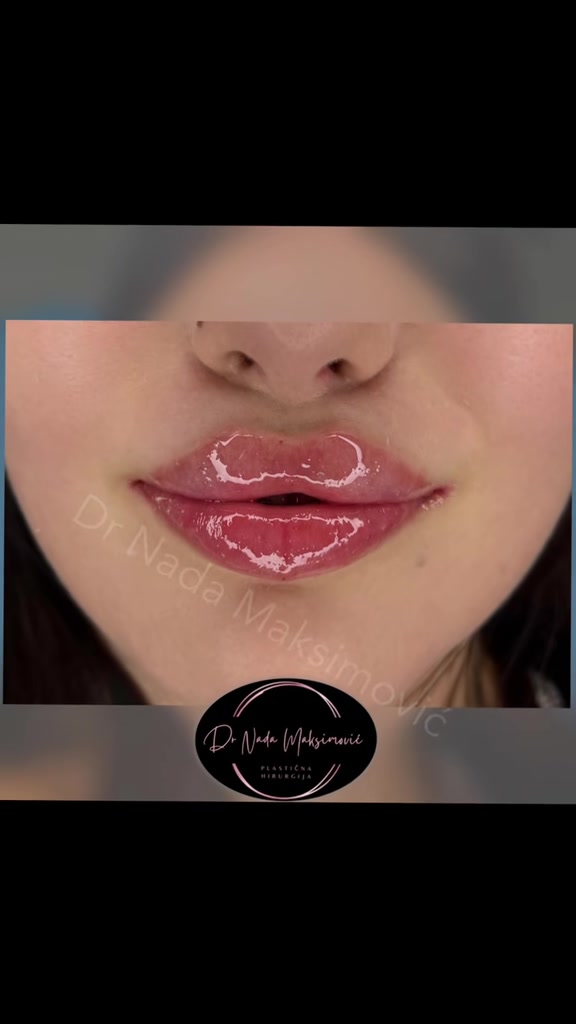 @Dr Nada Maksimovic