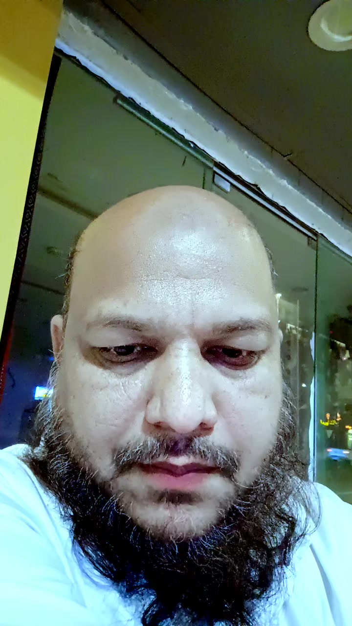 @Anand Mohan