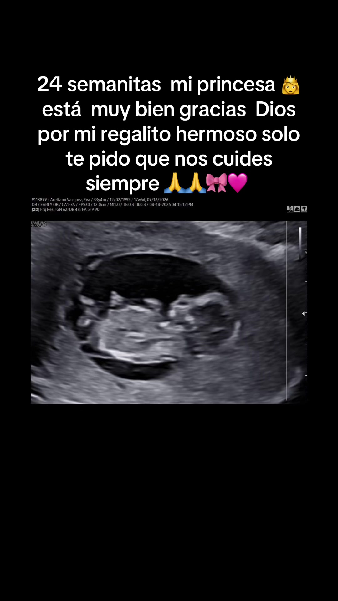 @Evita Arellano😘