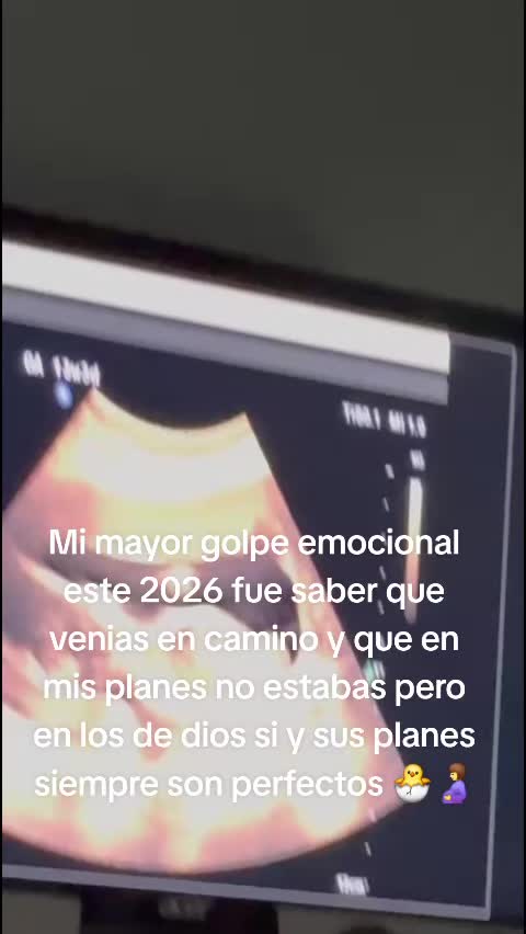 @💚 Roxy Jimenez 💚