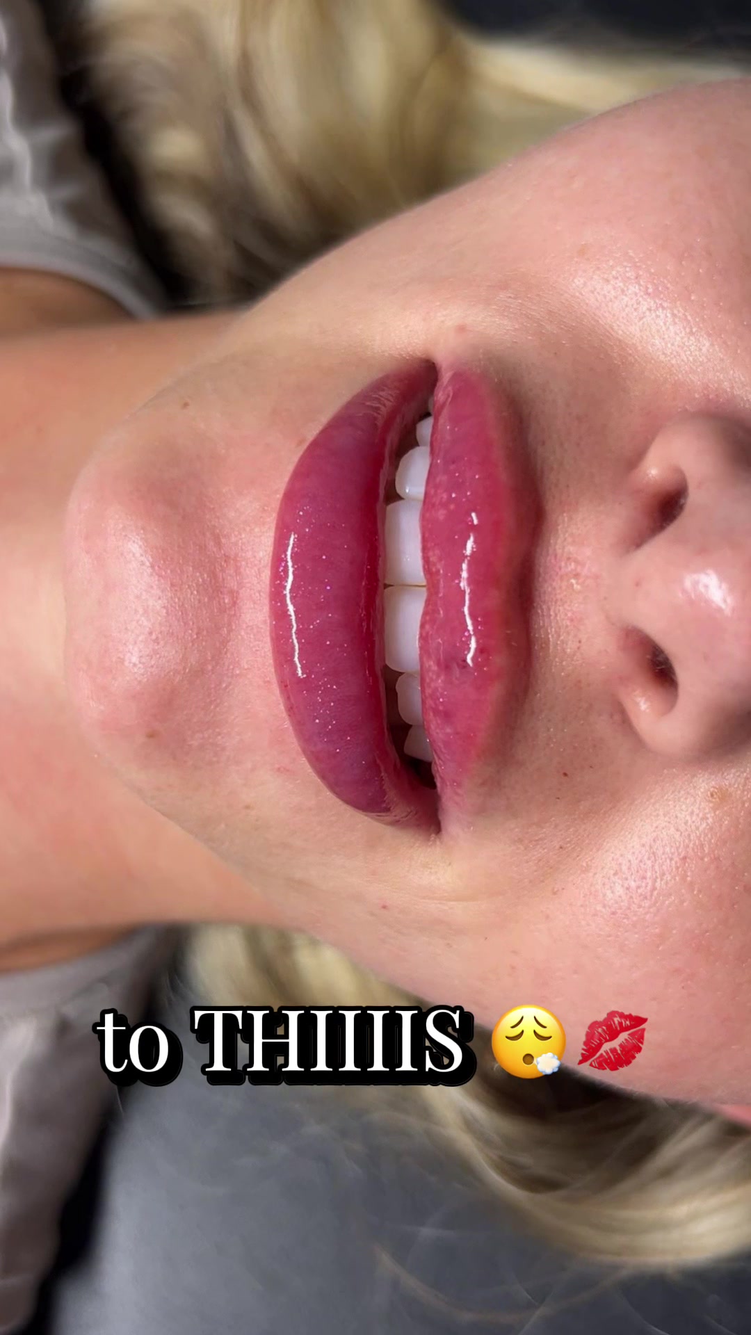@injectormami