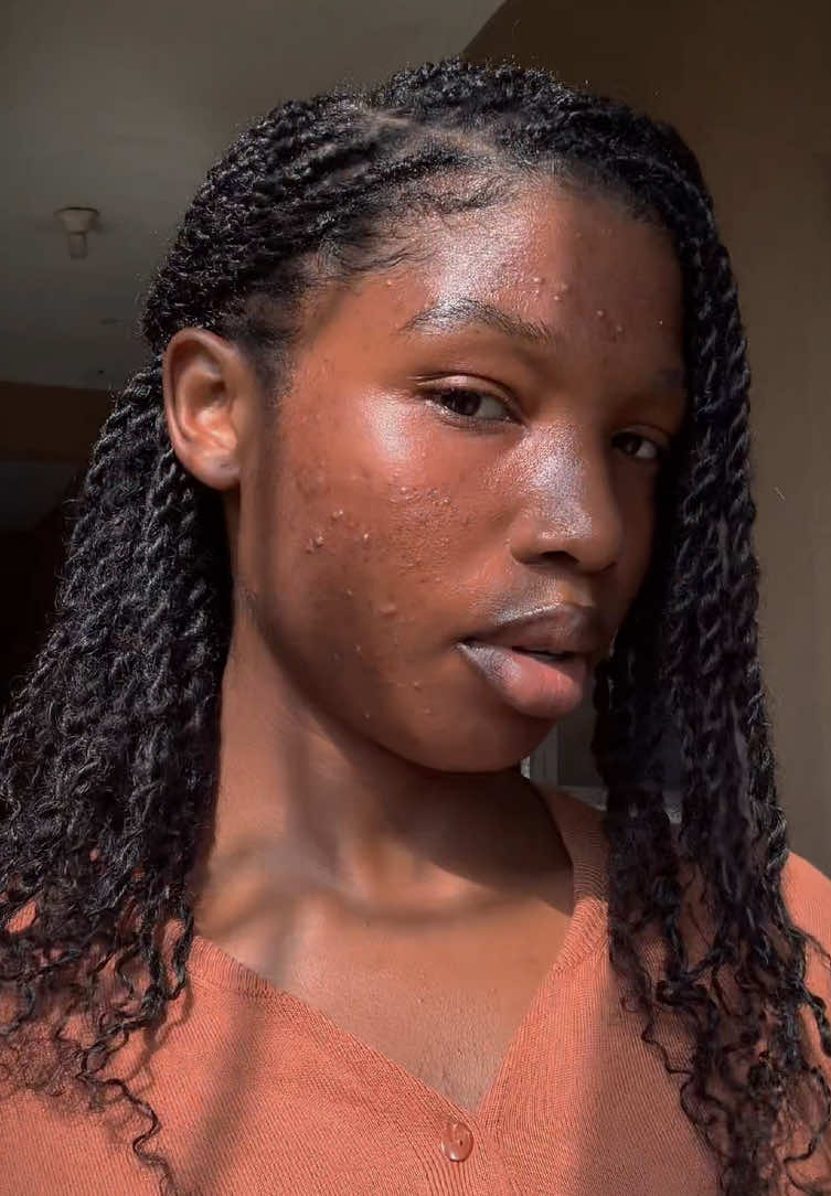 @Jhoi