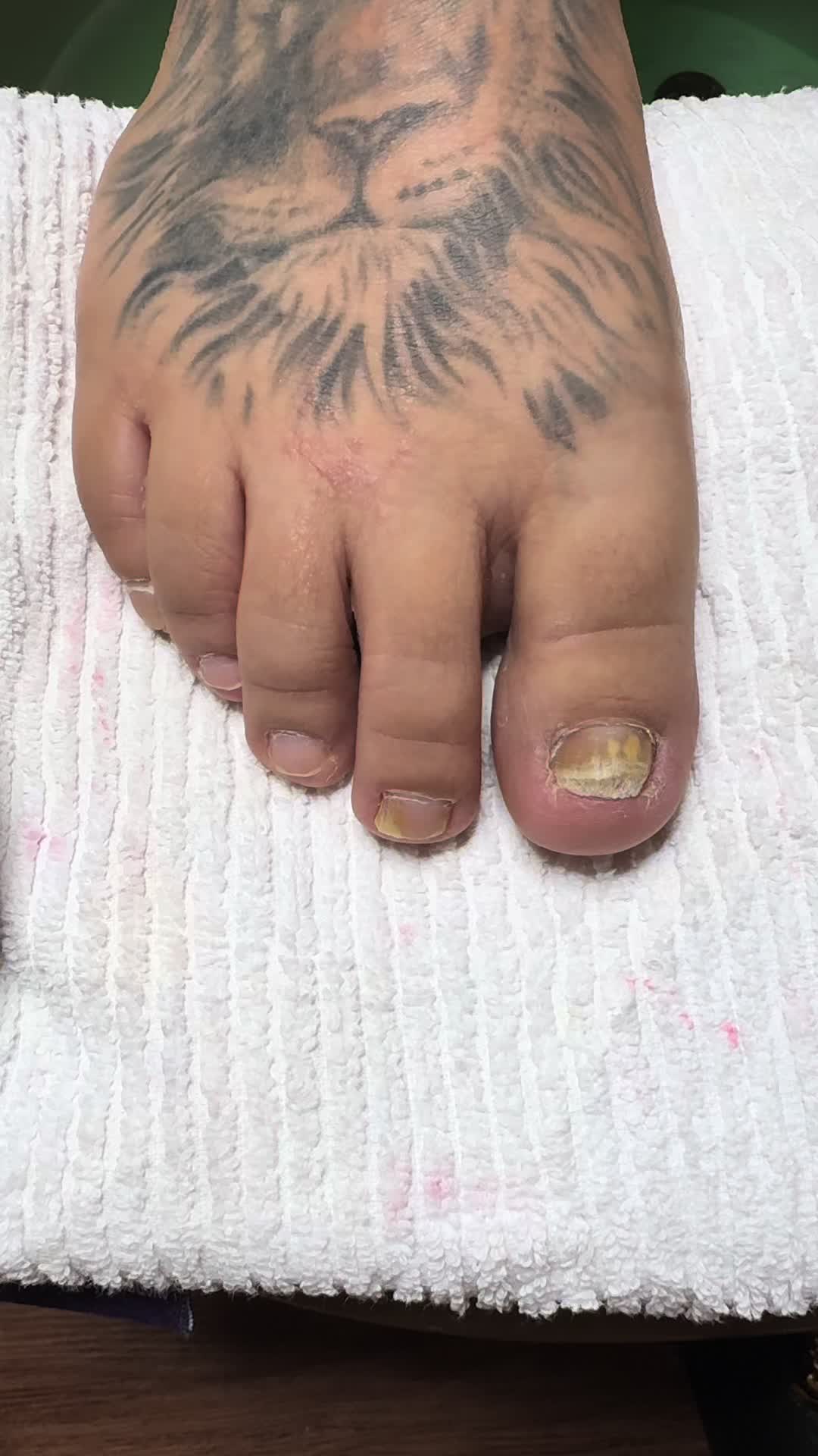 @ToesbyKoki