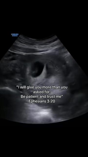 @lilblessings4dhd