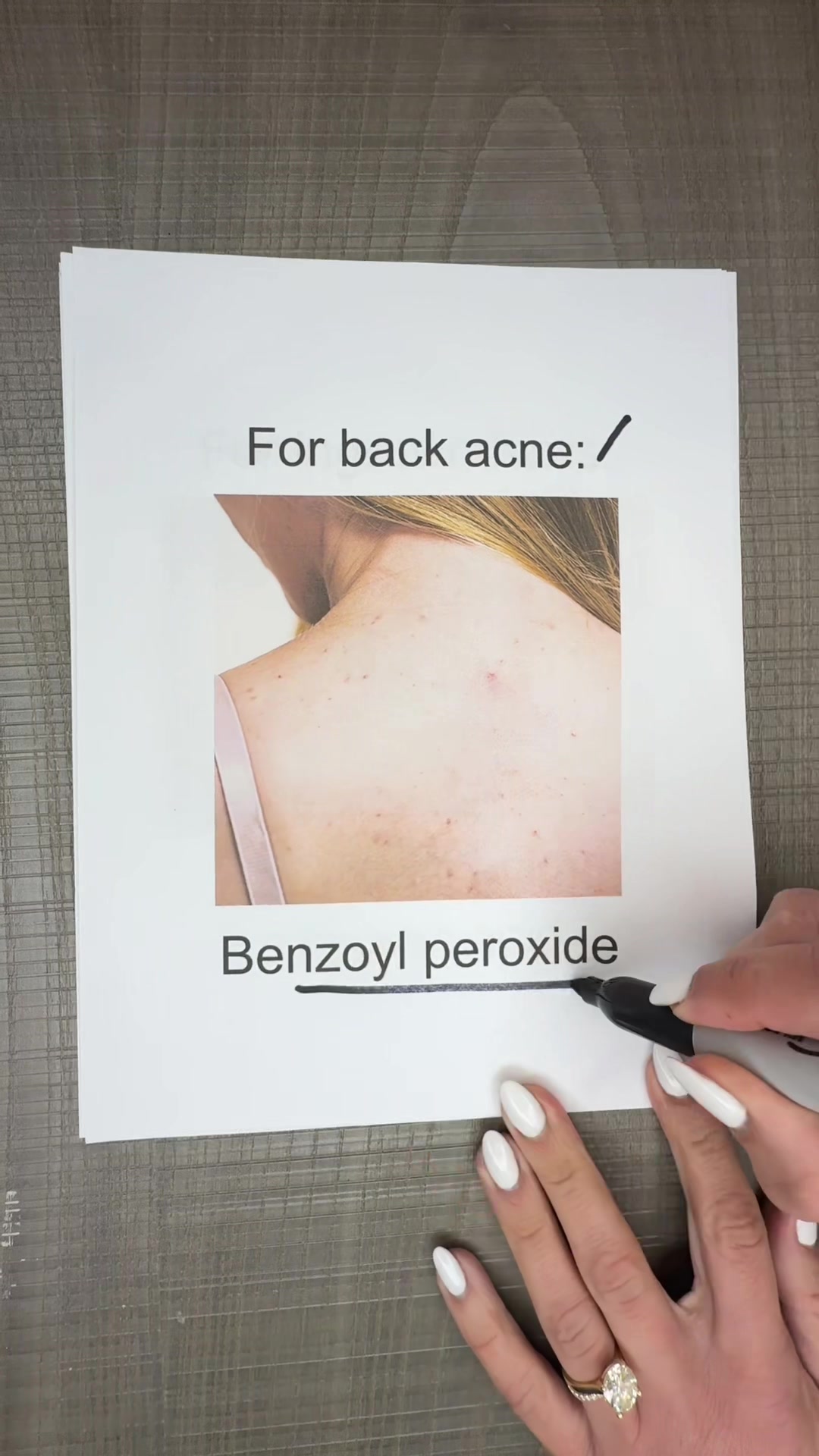 @Dermguru