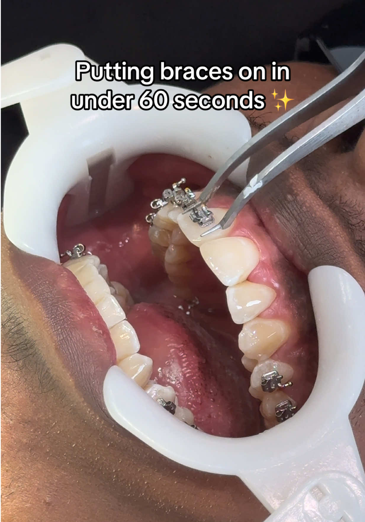 @Pure Orthodontics