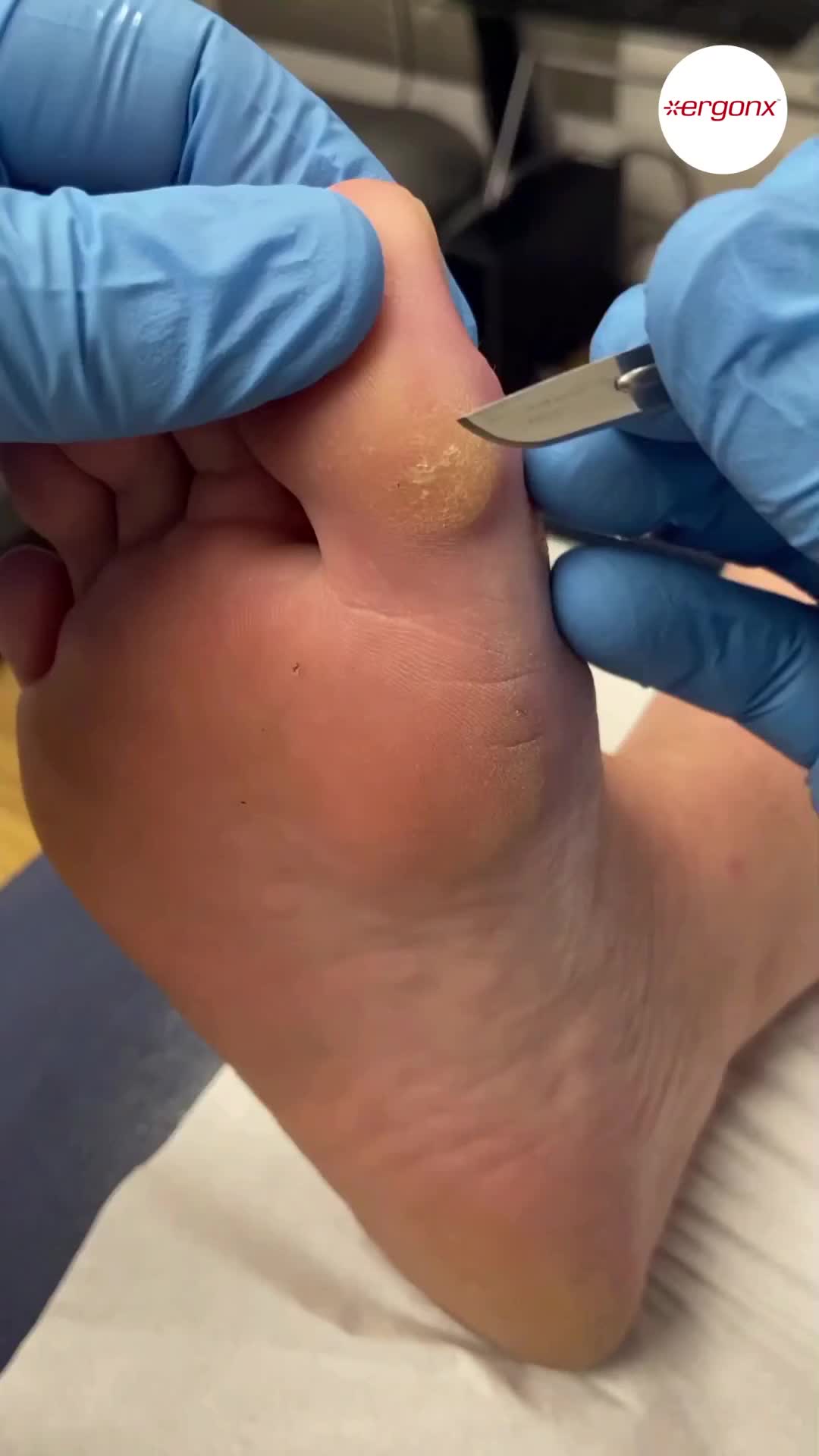 @ergonx