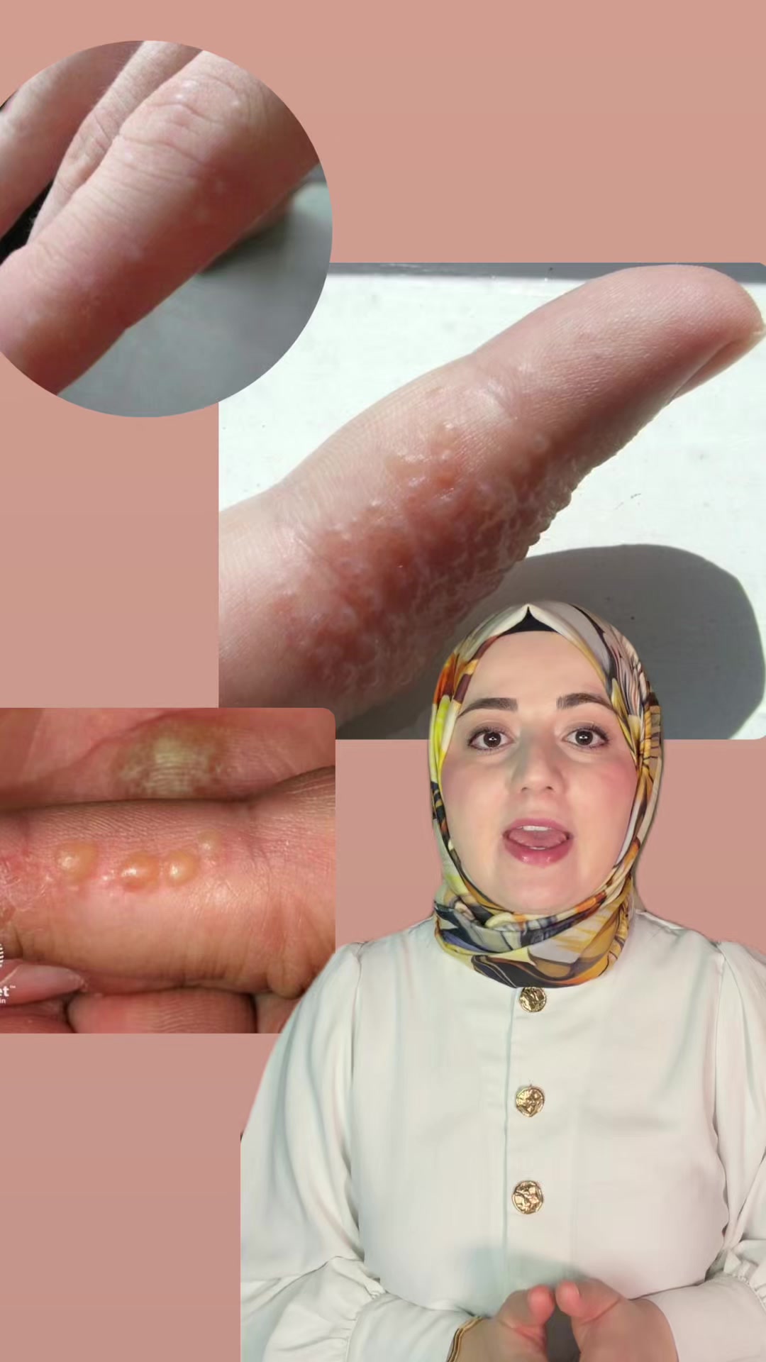 @Ecz. Meliha Reyhan-Cilt Bakımı