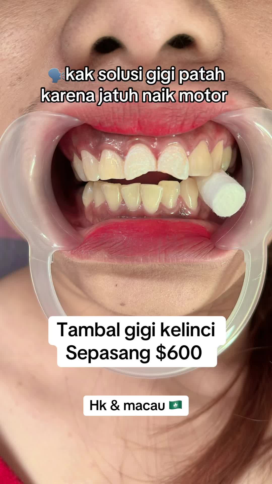 @mbak-Paijem