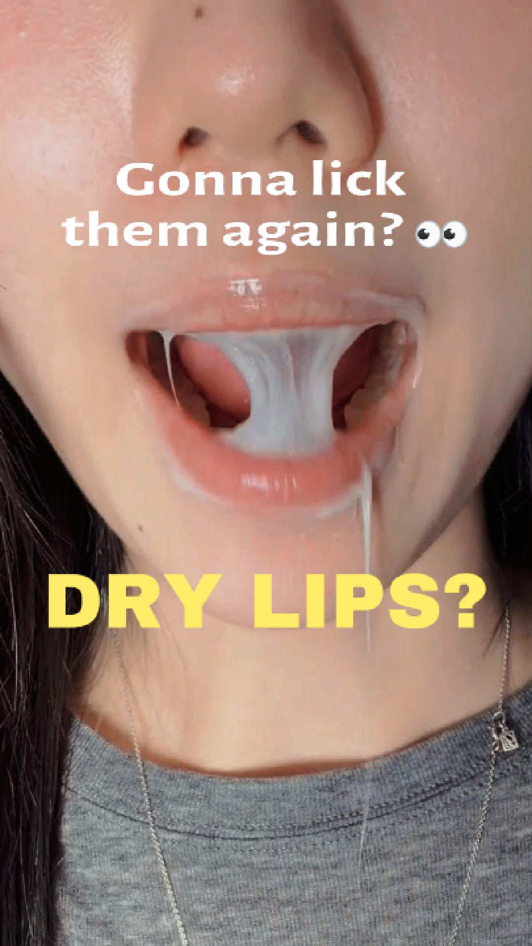 @Centellian24