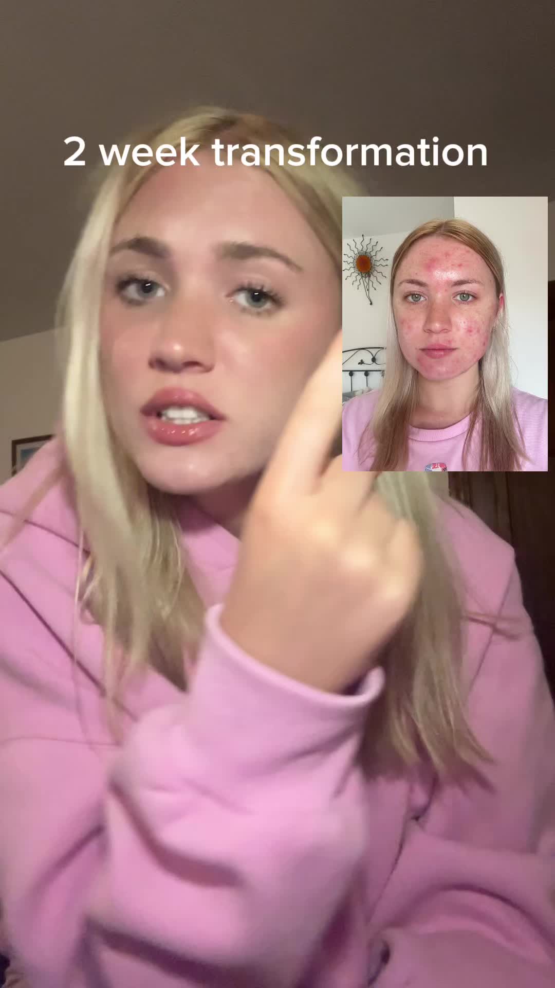 @bellytts