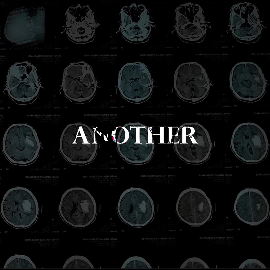 @MindTrace